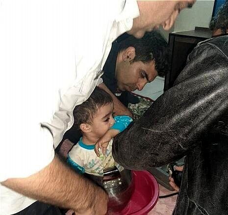 گرفتار شدن  کودک در زودپز